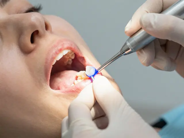 Co je bílá plomba? Vše, co potřebujete vědět o moderní zubní plombě