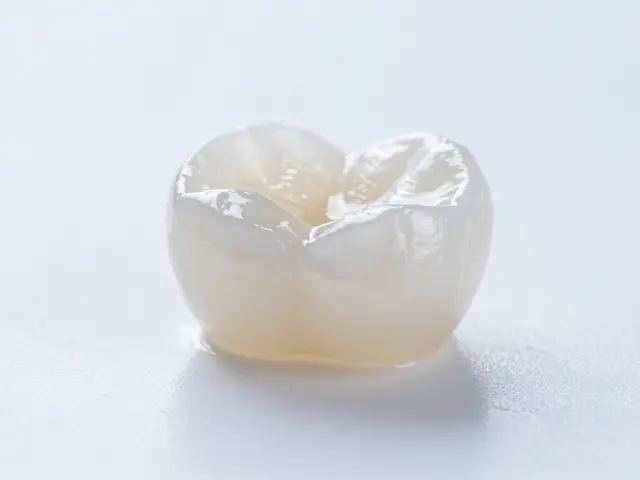 Celokeramické fazety: Cesta k dokonalému úsměvu za jeden den