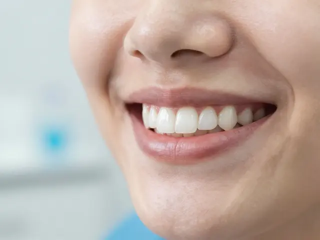 Zubní implantáty: Proč jsou skutečně nejlepší volbou při ztrátě zubů?