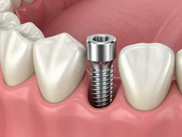 Zubní implantáty: Rizika, vedlejší účinky a realita po operaci