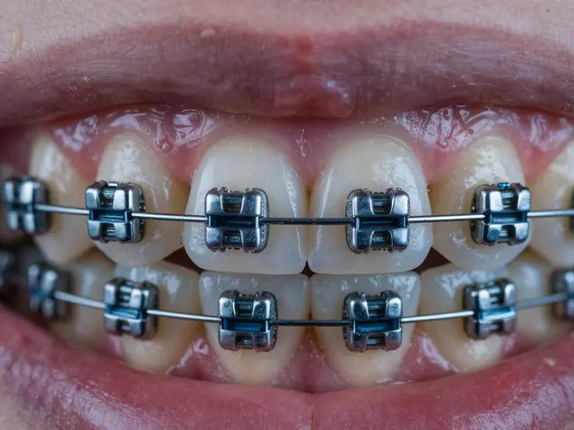Dentální hygiena při nošení zubních rovnátek: Kompletní průvodce pro zdravé zuby