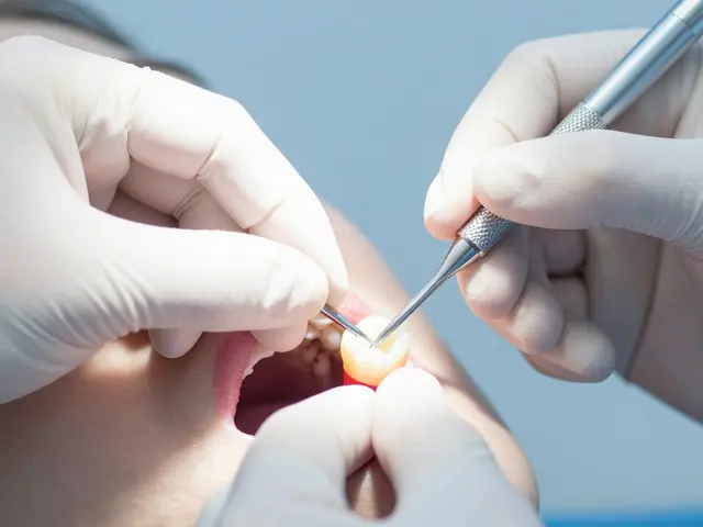 Co je to kořenová nástavba? Vše o kompozitních inlayech a záchraně zubů