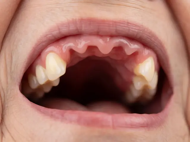 Proč nedrží zubní protéza? Příčiny a řešení